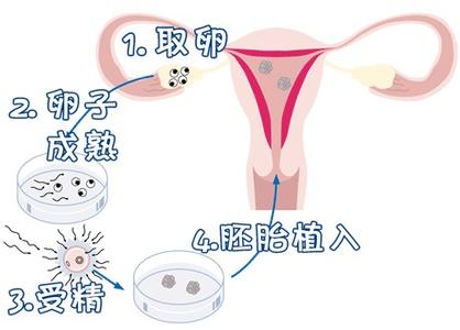 男性不育案例